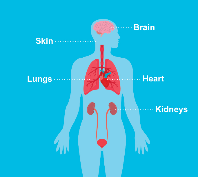 YSV Symptoms and complications image

